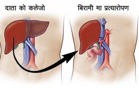 प्रतीकात्मक तस्बिर।