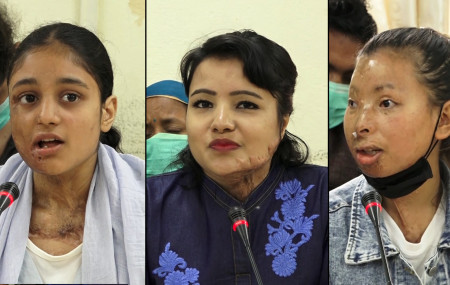 एसिड पीडितहरु बायाँबाट क्रमश मुस्कान खातुन, जेनी खड्का र संगीता मगर।