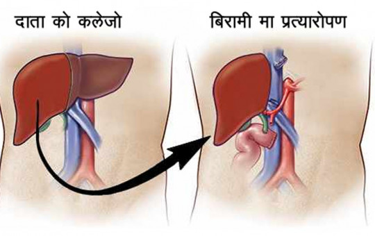 प्रतीकात्मक तस्बिर।